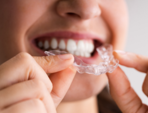 Why Choose Clear Aligner Therapy To Perfect Your Smile