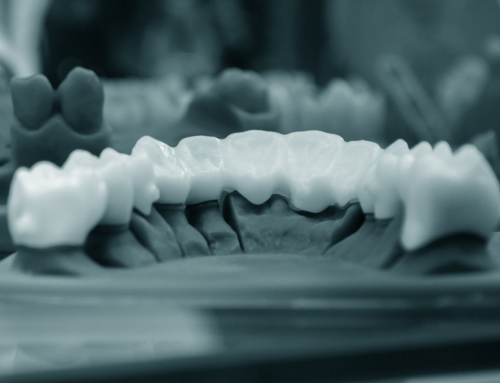 Revolutionizing Dentistry: Exploring the Benefits of Dental 3D Printing