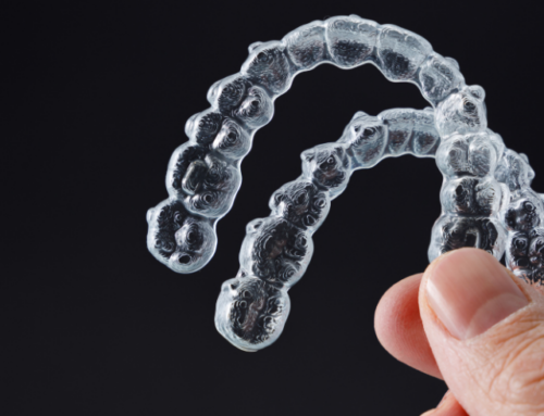 Straighten Your Teeth on Your Terms: Exploring Clear Teeth Aligners