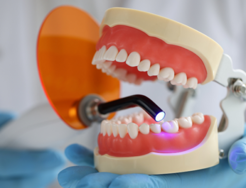The Role of Dental Fillings in Preventing Tooth Decay Progression