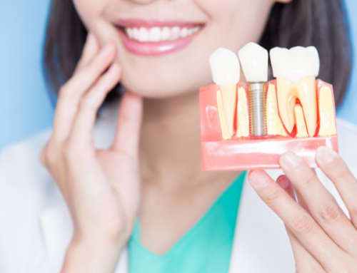 From Consultation to Recovery: Understanding Dental Implant Surgery